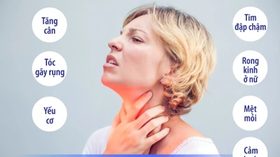 Nữ giới suy giáp cao gấp 8 lần nam giới, dấu hiệu cảnh báo