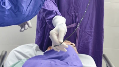 Lấy hạt hồng xiêm mắc kẹt trong phế quản cụ bà 90 tuổi
