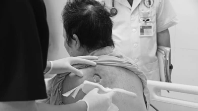 Uống nước đường giải độc theo thầy lang, người phụ nữ nguy kịch