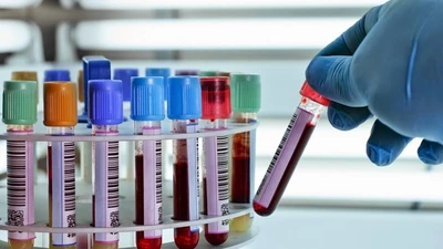 Giải mã trường hợp bé 7 tuổi mắc bệnh “bí ẩn”, phát hiện Enzym “khổng lồ”