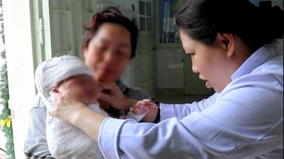 Phẫu thuật phục hồi đám rối thần kinh cánh tay cho trẻ 5 tháng tuổi