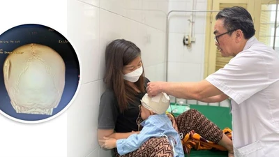 Đi qua đường, trẻ hơn 3 tuổi bị xe tông chấn thương sọ não