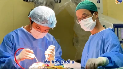 U não to như quả quýt được phát hiện tình cờ sau tai nạn