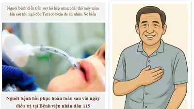 Ăn nhầm so biển, người đàn ông 52 tuổi liệt toàn thân