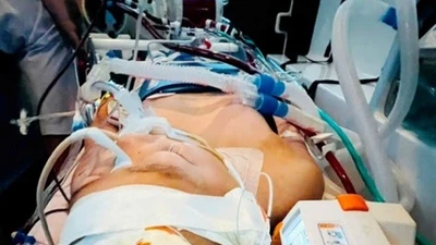 Phép màu cho cậu bé 12 tuổi xuất huyết não, ngừng tim