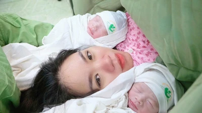 Ca sinh đôi chung bánh rau, buồng ối có một bé “đẻ bọc điều”