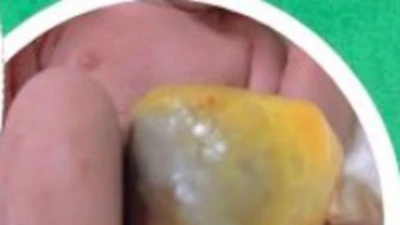 Sàng lọc trước sinh quyết định hành trình an toàn của mẹ và bé