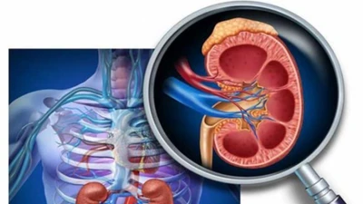 Dấu hiệu nhận biết sớm viêm cầu thận đừng bỏ qua
