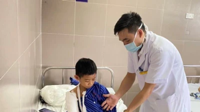 Vui chơi ngày hè, gần 50 trẻ ngã gãy lồi cầu xương cánh tay