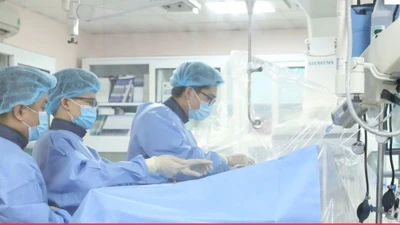 Đau bụng dưới 10 năm không ngờ do giãn tĩnh mạch buồng trứng