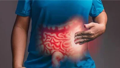 Hành trình cứu sống một ca xuất huyết ruột non nguy kịch