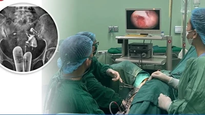Phẫu thuật nội soi tách dính buồng tử cung cho người phụ nữ 38 tuổi