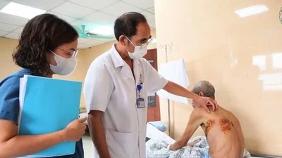Tự điều trị zona tại nhà, cụ ông 77 tuổi gặp biến chứng nguy hiểm