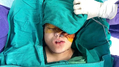 Hành trình nhân đạo loại bỏ khối u "khổng lồ" tái tạo mặt cho bé gái 16 tuổi