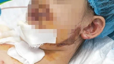 Nhiều trẻ nguy kịch vì tai nạn thương tích ngày hè