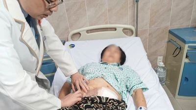Đại tiện ra máu tưởng do trĩ không ngờ ung thư đại tràng