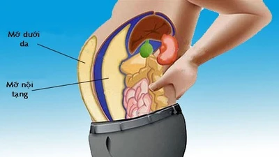 Những thói quen gây tích mỡ bụng, mỡ nội tạng