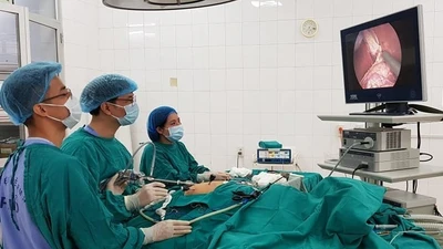 Bé 10 tuổi bị nang ống mật chủ 7 cm
