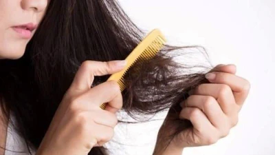 Kích thích huyệt phục hồi tóc rụng sau sốt xuất huyết