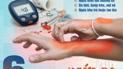 Biểu hiện trên da cảnh báo bệnh đái tháo đường