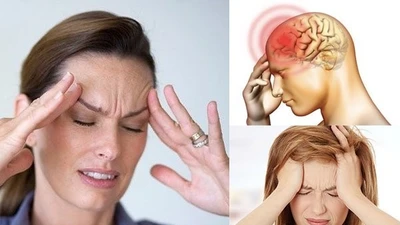 Đau nửa đầu Migraine tiềm ẩn nguy cơ đột quỵ não
