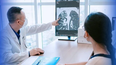 Đau lưng kéo dài, bé gái 15 tuổi phát hiện lao phổi tổn thương mạch máu