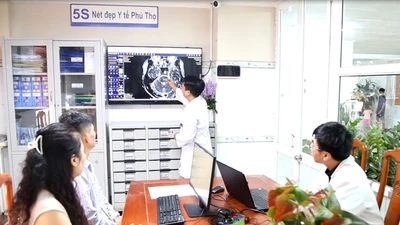 Sóng xung trị liệt mặt nhiều năm do đau dây thần kinh số 5