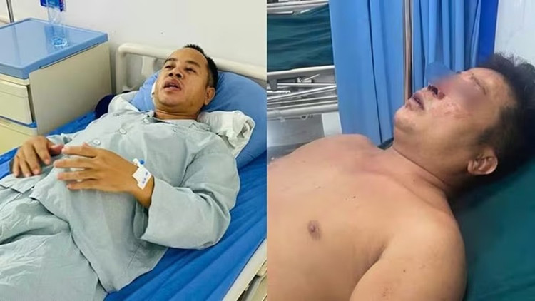 Anh Nguyễn Đức Vĩnh (bên trái) bị chấn thương phần mềm nặng, đứt một bên tai và anh Nguyễn Bá Trung bị đa chấn thương. cats.jpg