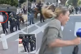 Nữ phóng viên trúng đạn khi đưa tin biểu tình ở Los Angeles