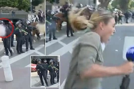 Nữ phóng viên trúng đạn khi đưa tin biểu tình ở Los Angeles