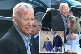 Hình ảnh mới nhất gây lo ngại về sức khỏe của ông Biden