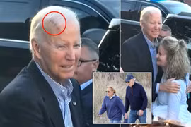 Hình ảnh mới nhất gây lo ngại về sức khỏe của ông Biden