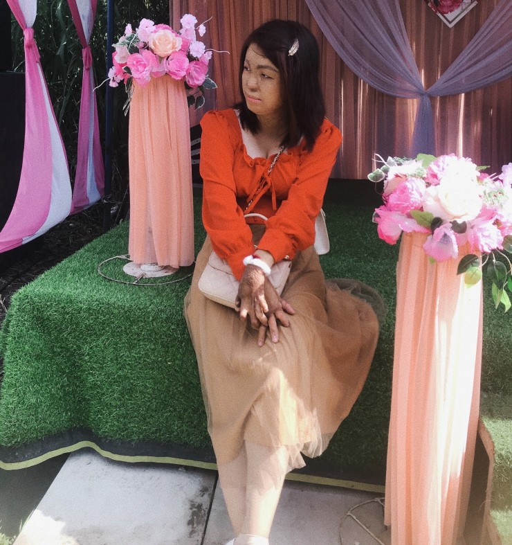 Người vợ 8 năm vượt qua cơn ác mộng bị chồng tưới xăng đốt Nguoi vo 8 nam vuot qua con ac mong bi chong tuoi xang dot