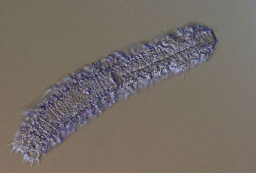 2. Gastrotricha (tuổi thọ trung bình: 3 ngày).