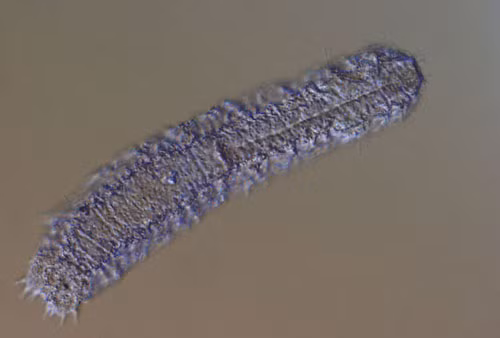 2. Gastrotricha (tuổi thọ trung bình: 3 ngày).