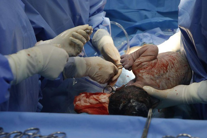 7 phut than ky cuu thai nhi va san phu bi tai nan giao thong