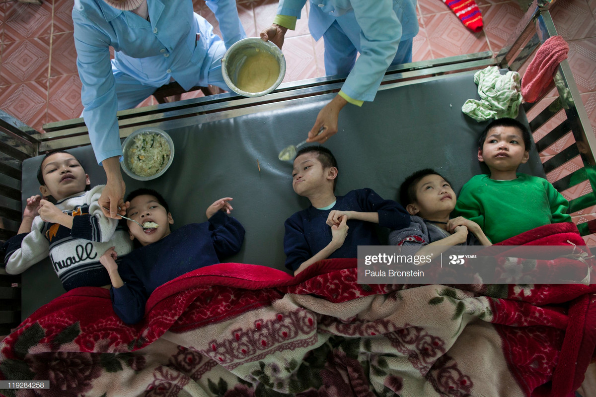 Trẻ mồ côi khuyết tật được nhân viên y tế cho ăn tại trại trẻ mồ côi Ba Vi, Hà Nội ngày 15/3/2011.