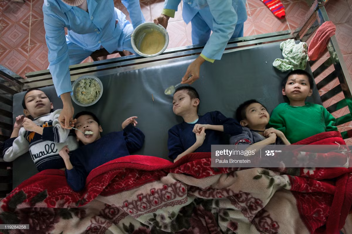 Trẻ mồ côi khuyết tật được nhân viên y tế cho ăn tại trại trẻ mồ côi Ba Vi, Hà Nội ngày 15/3/2011.