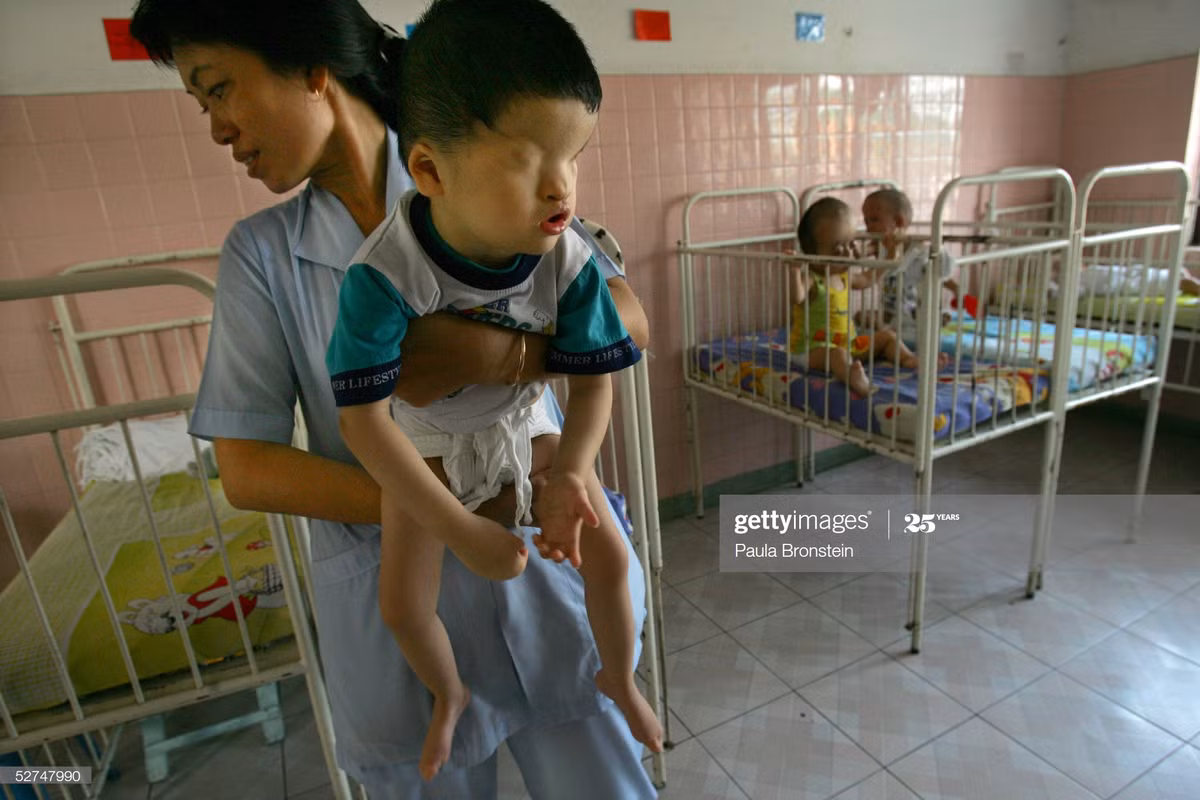 Một y tá bế em bé khuyết tật tại Làng Hòa Bình, cơ sở chăm sóc trẻ em chịu di chứng chất độc da cam trực thuộc Bệnh viện Từ Dũ, TP HCM năm 2005.