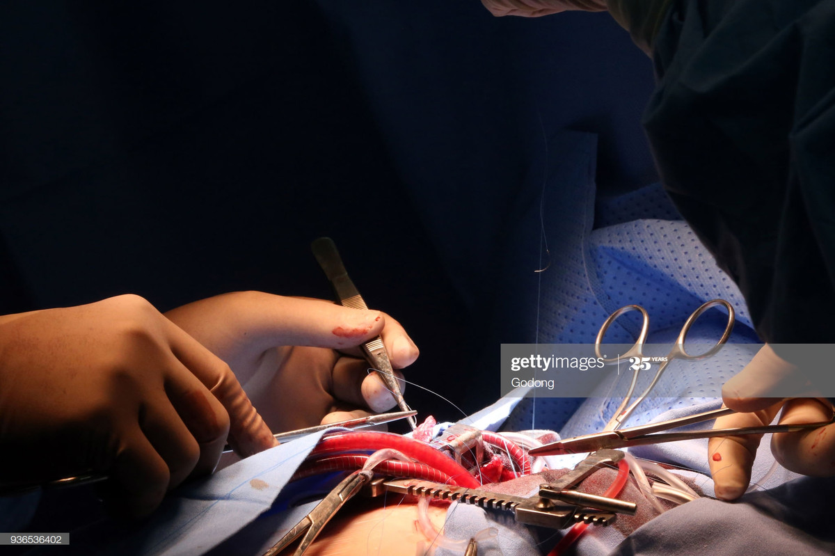 Một ca phẫu thuật tim ở Viện tim TP HCM năm 2016.