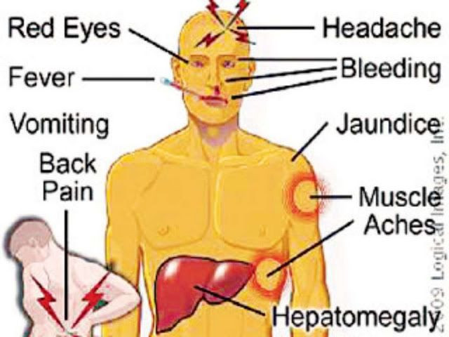 Các triệu chứng điển hình là sốt, gai rét, nhức đầu, đau cơ và nôn mửa. Mức độ bệnh có thể dao động từ sốt nhẹ đến nhiễm trùng, xuất huyết nội tạng, suy đa phủ tạng và tử vong. Suy gan gây vàng da là triệu chứng rất hay gặp của căn bệnh này, do đó bệnh được đặt tên là sốt vàng da.