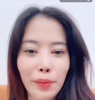 Nam Em lan dau thua nhan 'tham my hong' mot diem tren guong mat-Hinh-2