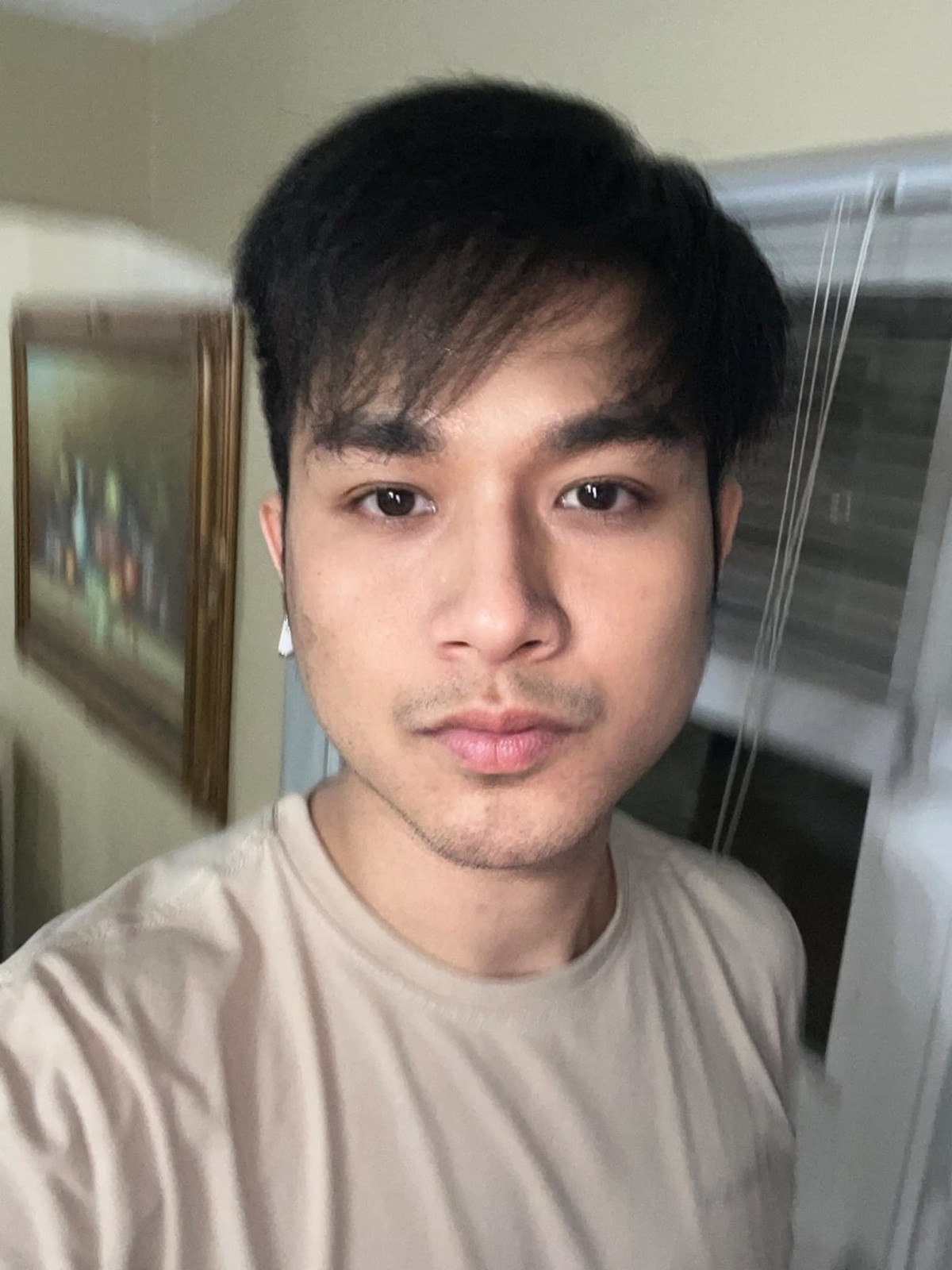 Ca sĩ Quách Tuấn Du tiều tụy do bệnh.