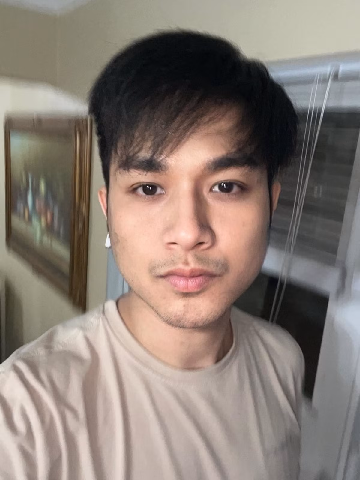 Ca sĩ Quách Tuấn Du tiều tụy do bệnh.