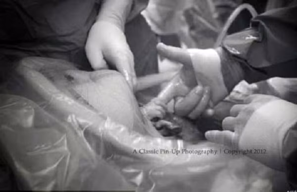 Trong quá trình sinh con, sản phụ phải tuân thủ theo hướng dẫn của bác sĩ, ví dụ như: khi đầu của thai nhi bắt đầu ra, sản phụ ngừng rặn đẻ. Điều này sẽ giúp đảm bảo rằng em bé được sinh ra một cách nhẹ nhàng, nhanh chóng, giảm thiểu tình trạng bị xé rách tầng sinh môn.