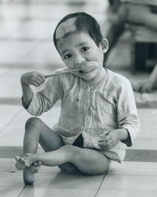 Nhiều em gầy gò đến mức đi không vững trên đôi chân của mình.