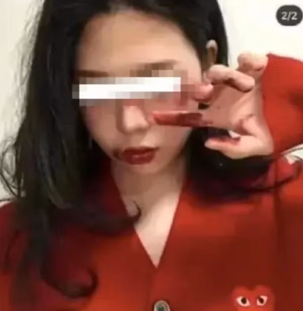 Loat ban tre xuat hien voi guong mat bam tim nhu bi bao hanh-Hinh-3