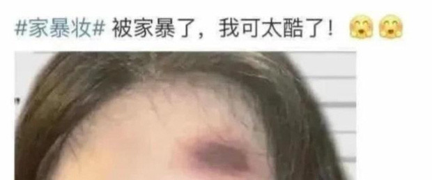 Loat ban tre xuat hien voi guong mat bam tim nhu bi bao hanh