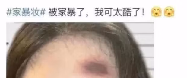 Loat ban tre xuat hien voi guong mat bam tim nhu bi bao hanh