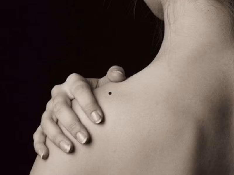  2 nốt ruồi phá tướng cẩn trọng tai ương. Nốt ruồi trên vai: Trong nhân tướng học người xưa thường nói "nốt ruồi ở vai cả đời gánh vác" ý nói nốt ruồi ở vị trí này khiến gia chủ lúc nào cũng phải lo lắng, suy nghĩ chẳng mấy khi được thảnh thơi. 